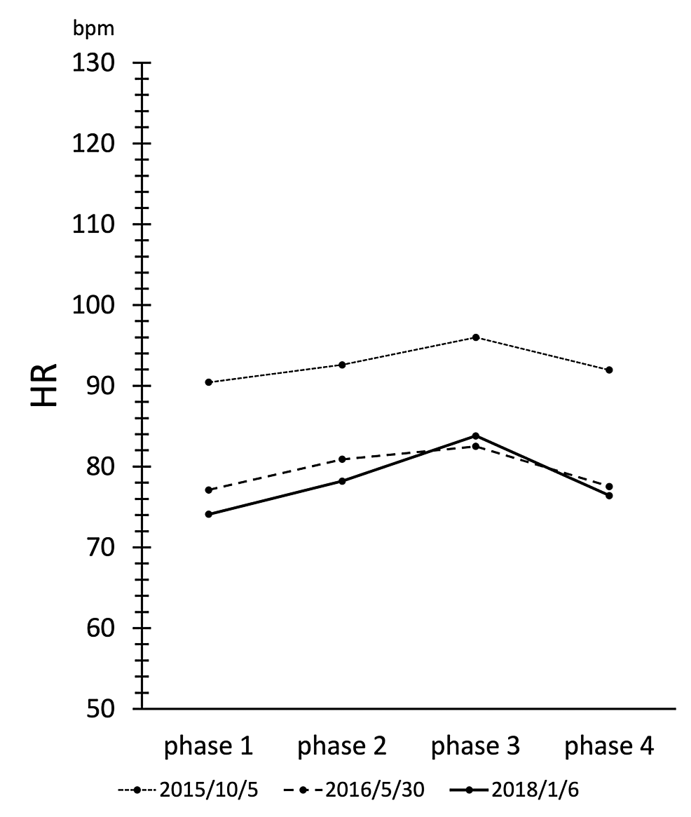 Cureus A Case Report of Chronic Epipharyngitis With Chronic Fatigue