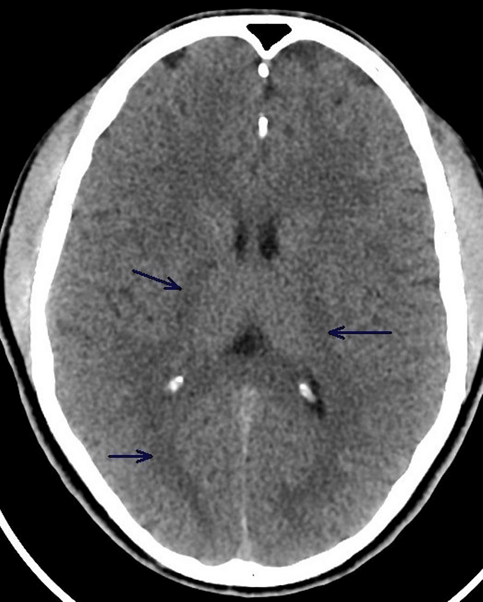 Ornithine Transcarbamylase (OTC) Deficiency Treatment Market Size, Share \u0026  Trends 2030, image size:986x1229
