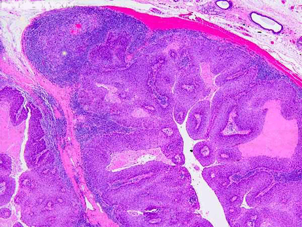 Cureus | A Comprehensive Analysis of Histopathologic Examination ...