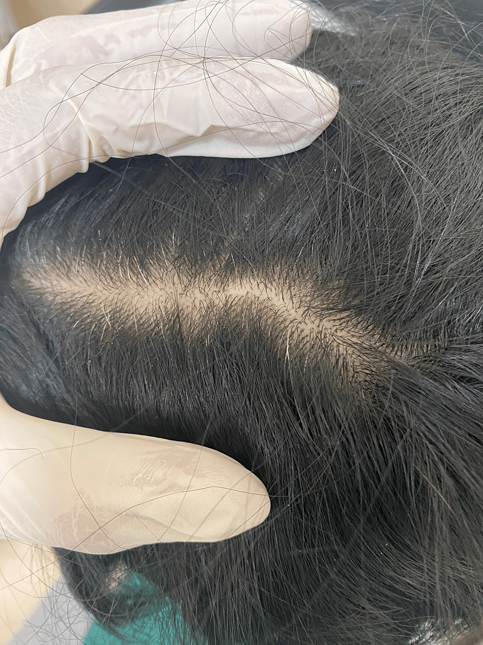 where to buy b12 injections reddit When Milo is distracted with his wet food meal he gets his weekly B12  injection on Thursdays , Milo is blind and was born with severe  Cerebellar Hypoplasia, a condition which affects his mobility