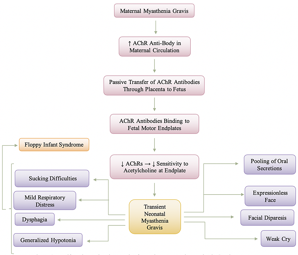 Manifestation-and-Pathogenesis-of-Transient-Neonatal-Myasthenia-Gravis