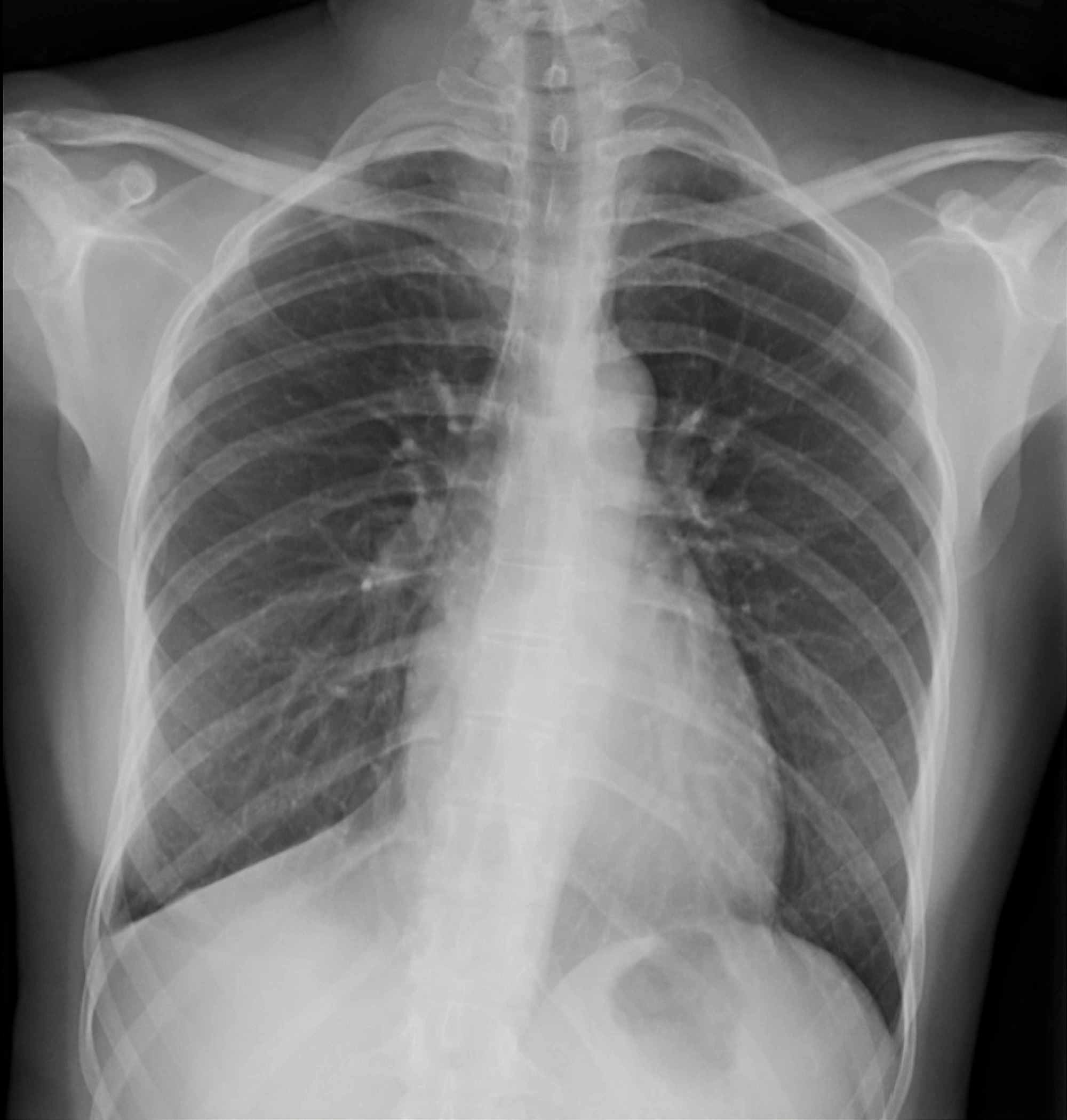 Cureus | Multimodality Thoracoabdominal Imaging Findings in a Rare Case ...