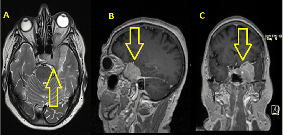 小児神経の画像診断 = Diagnostic Imaging of Infan… 小児神経の画像診断 改訂第2版: ―脳脊髄から頭頸部・骨軟部まで