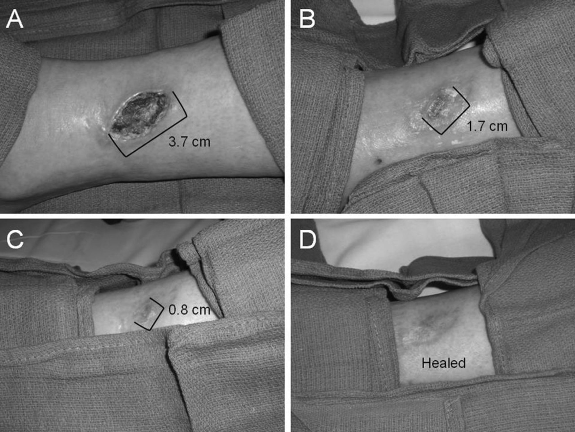 Cureus The Effects of Spinal Cord Stimulators on End Organ Perfusion