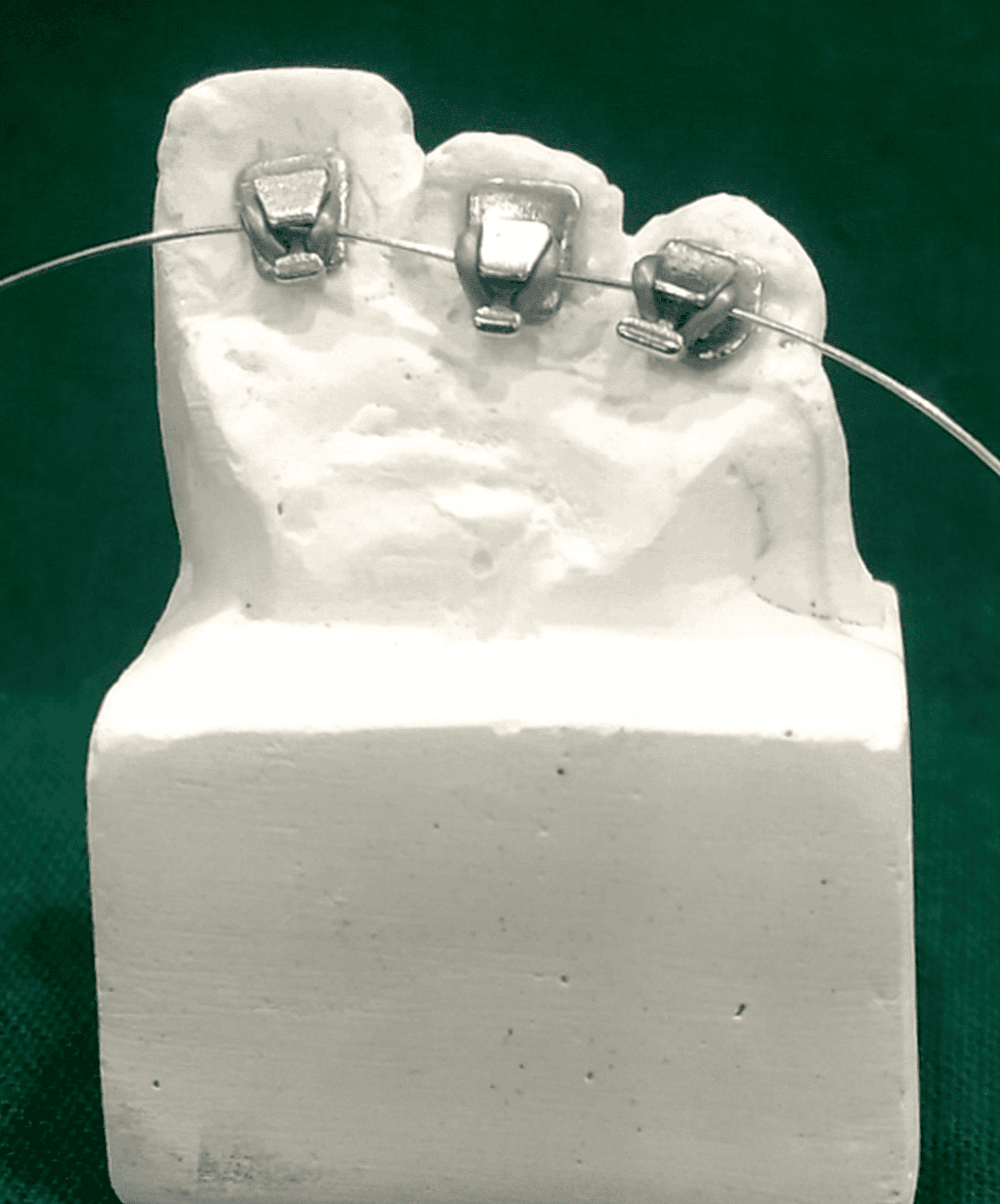 Cureus A Comparative Evaluation of Frictional Resistance of Various