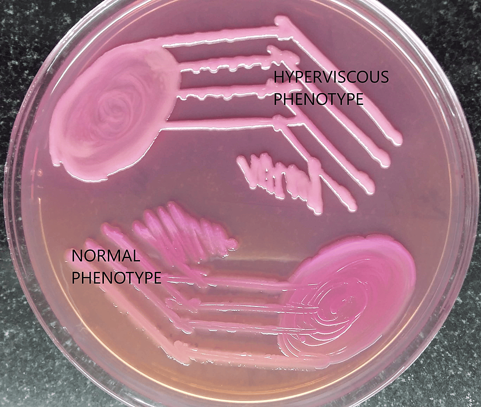 klebsiella macconkey agar