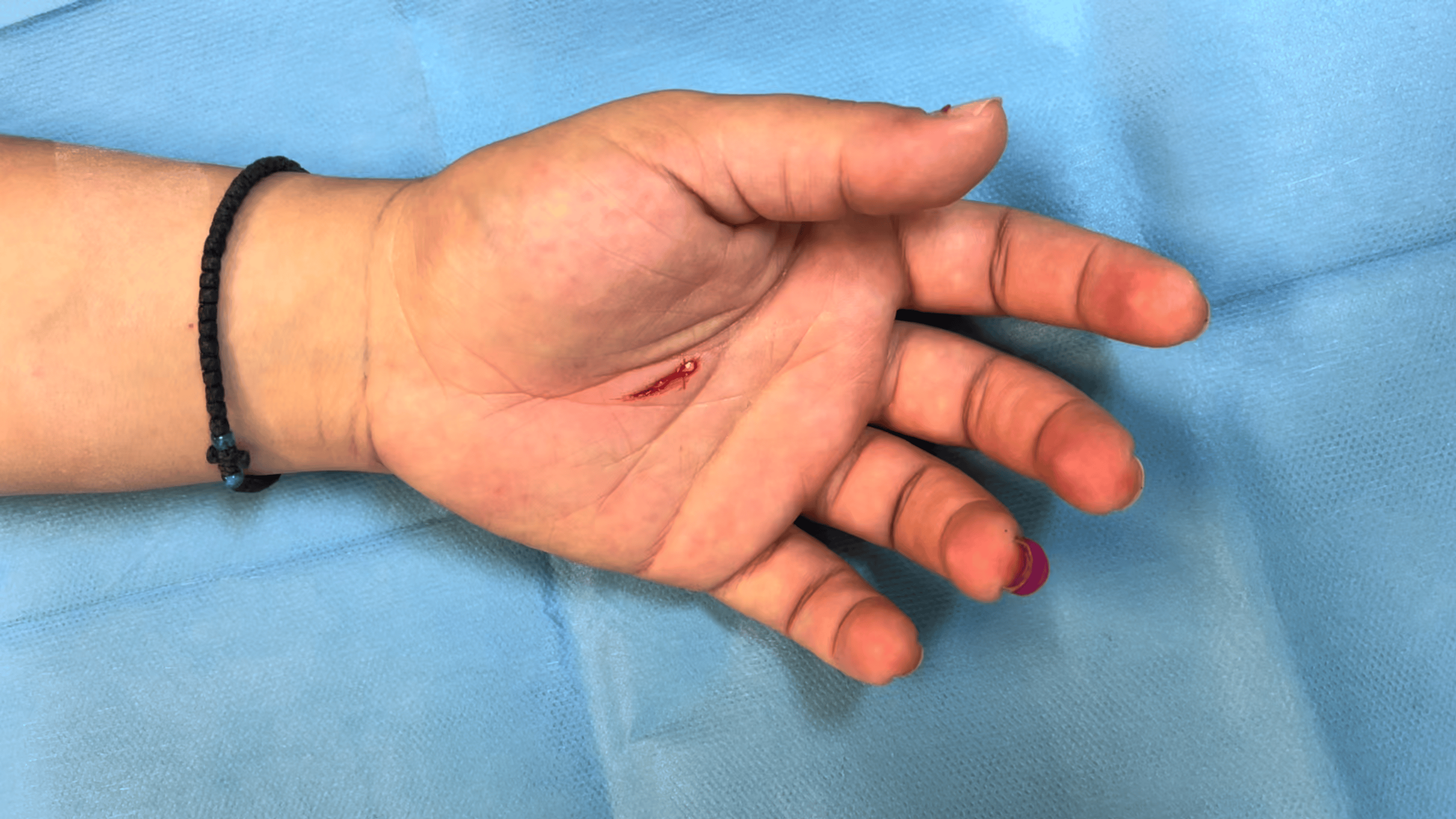 Left Palm Is Itchingnotifications - a2vhrs8