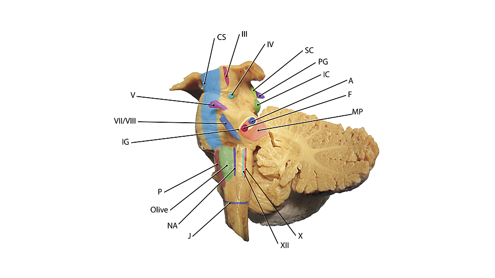 Cureus | Mapping the Internal Anatomy of the Lateral Brainstem