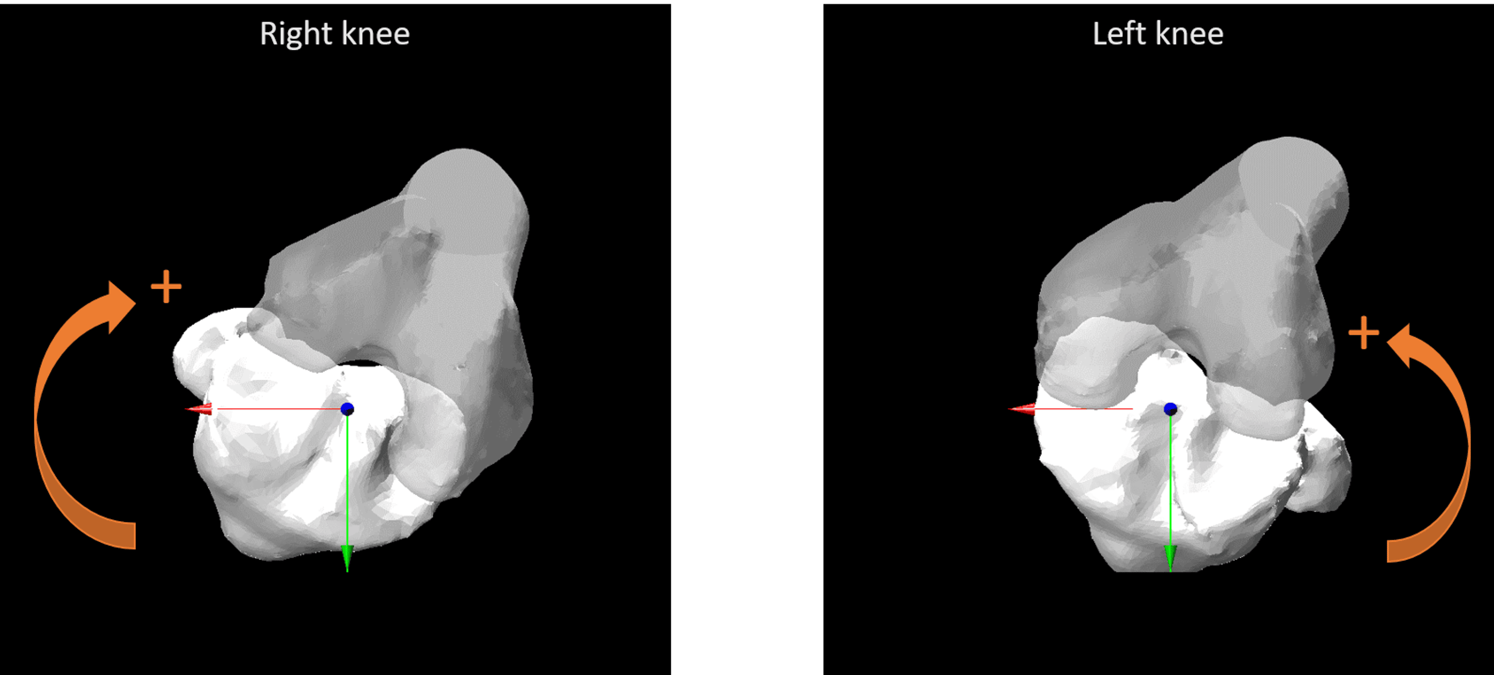 Sitting Sideways Causes Different Femoral-Tibial Rotations in Each Knee ...