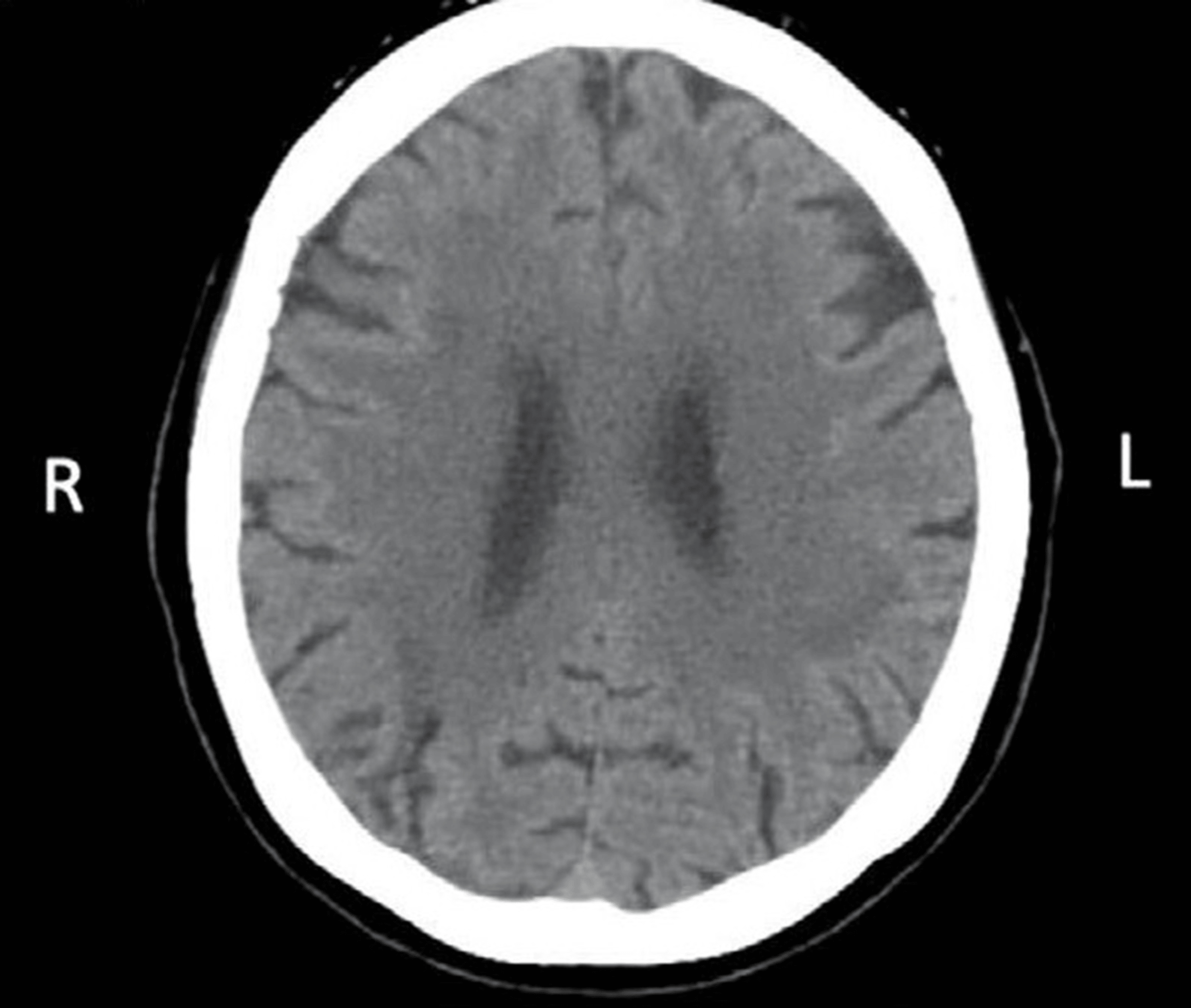 Tachysensia Causes - k1nrs15