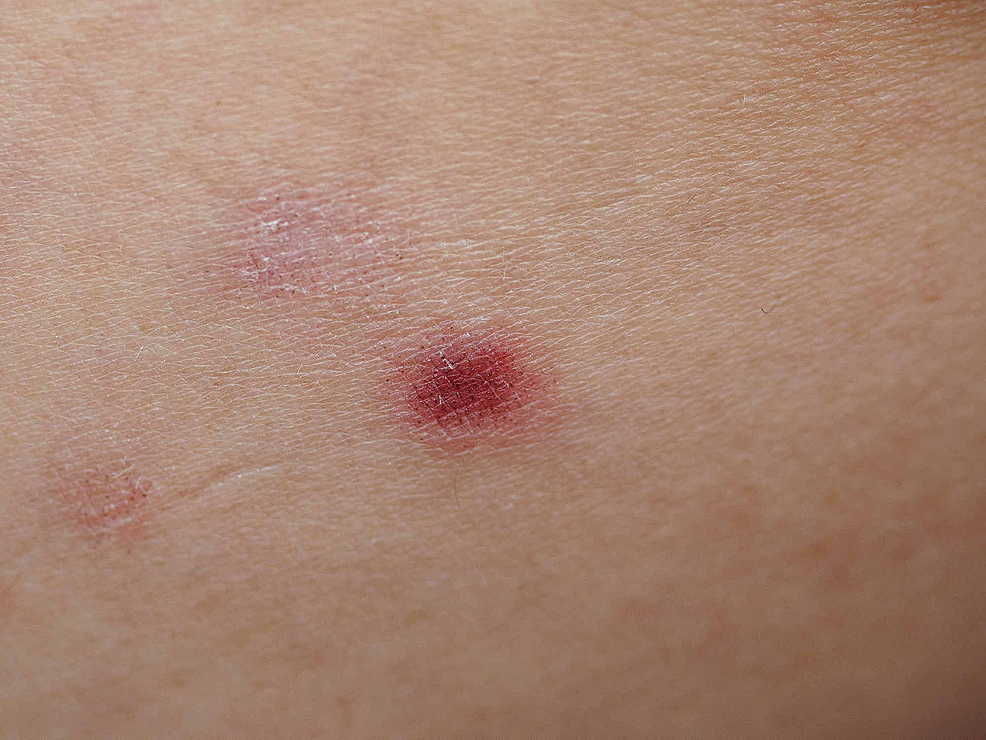pinpoint red dots on skin itchy groups of 3