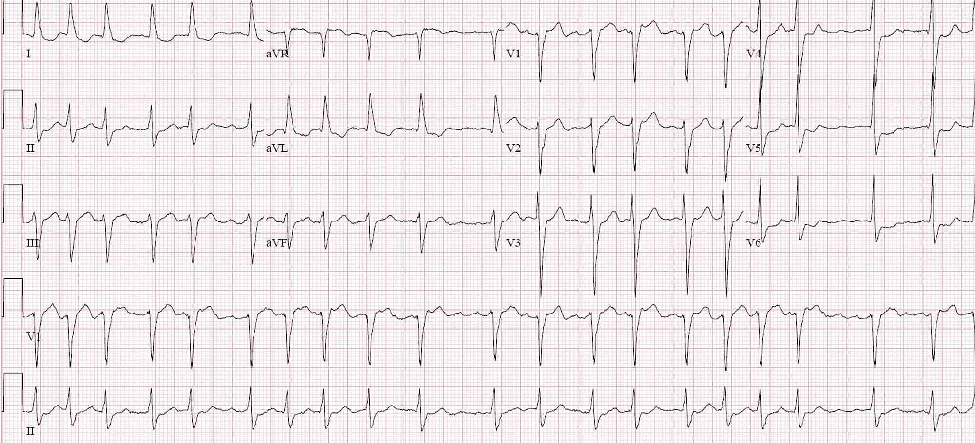 Cureus | N-acetyl Cysteine Use in the Treatment of Shock Liver