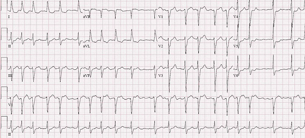 Cureus | N-acetyl Cysteine Use in the Treatment of Shock Liver