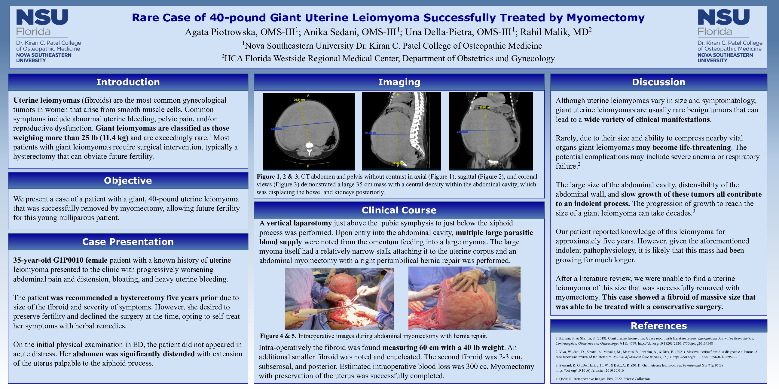 Cureus | Rare Case of 40-pound Giant Uterine Leiomyoma Successfully ...