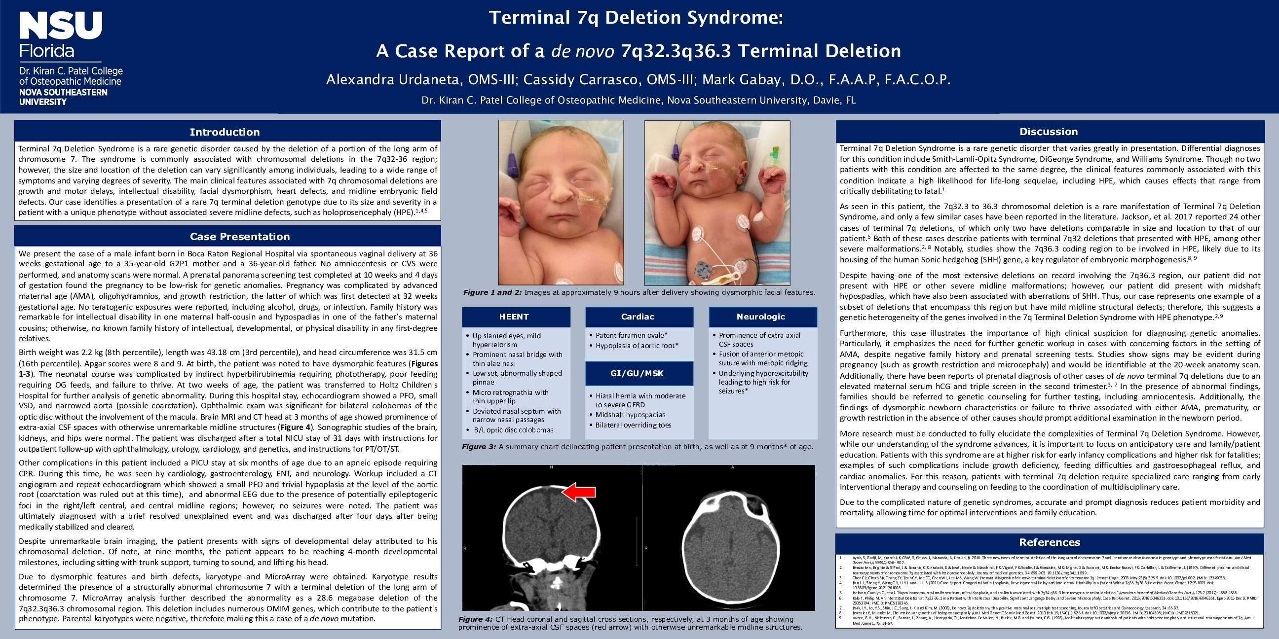 Cureus Terminal 7q Deletion Syndrome A Case Report of a de novo 7q32