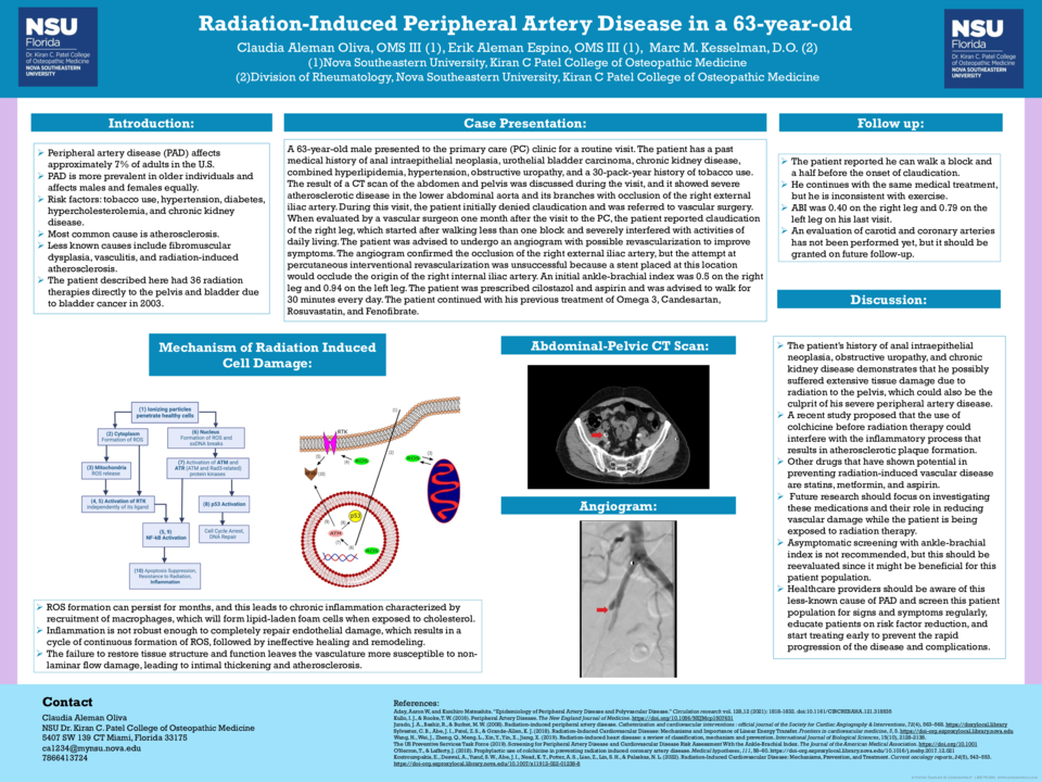 Cureus | Radiation-Induced Peripheral Artery Disease in a 63-year-old