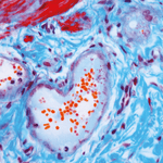 Hassan A. Gadain Hassan